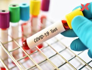 Telangana COVID-19: 2,000 People Who Tested Positive For COVID-19 Go 'Missing'