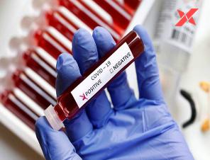 Coronavirus:  India sees 35,000 COVID cases in a single day, touches one-million mark 